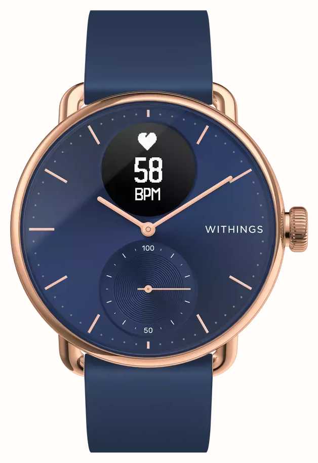 Withings Scanwatch 38 mm okosóra - inSPORTline